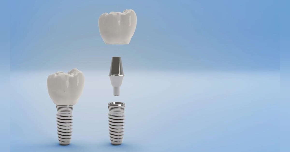 Gunbarrel Dental Center Releases Guidance on Professional Teeth Whitening Options