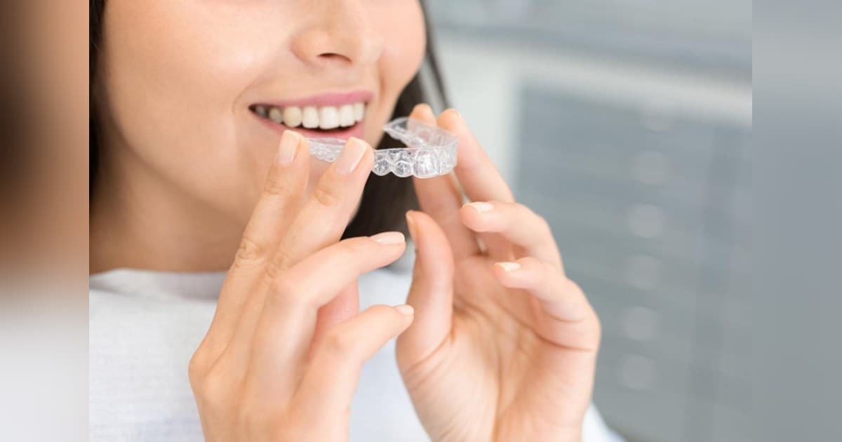 Feldman Orthodontics Compares Clear Ceramic and Metal Braces for Families in Cheshire, Wallingford, and North Haven